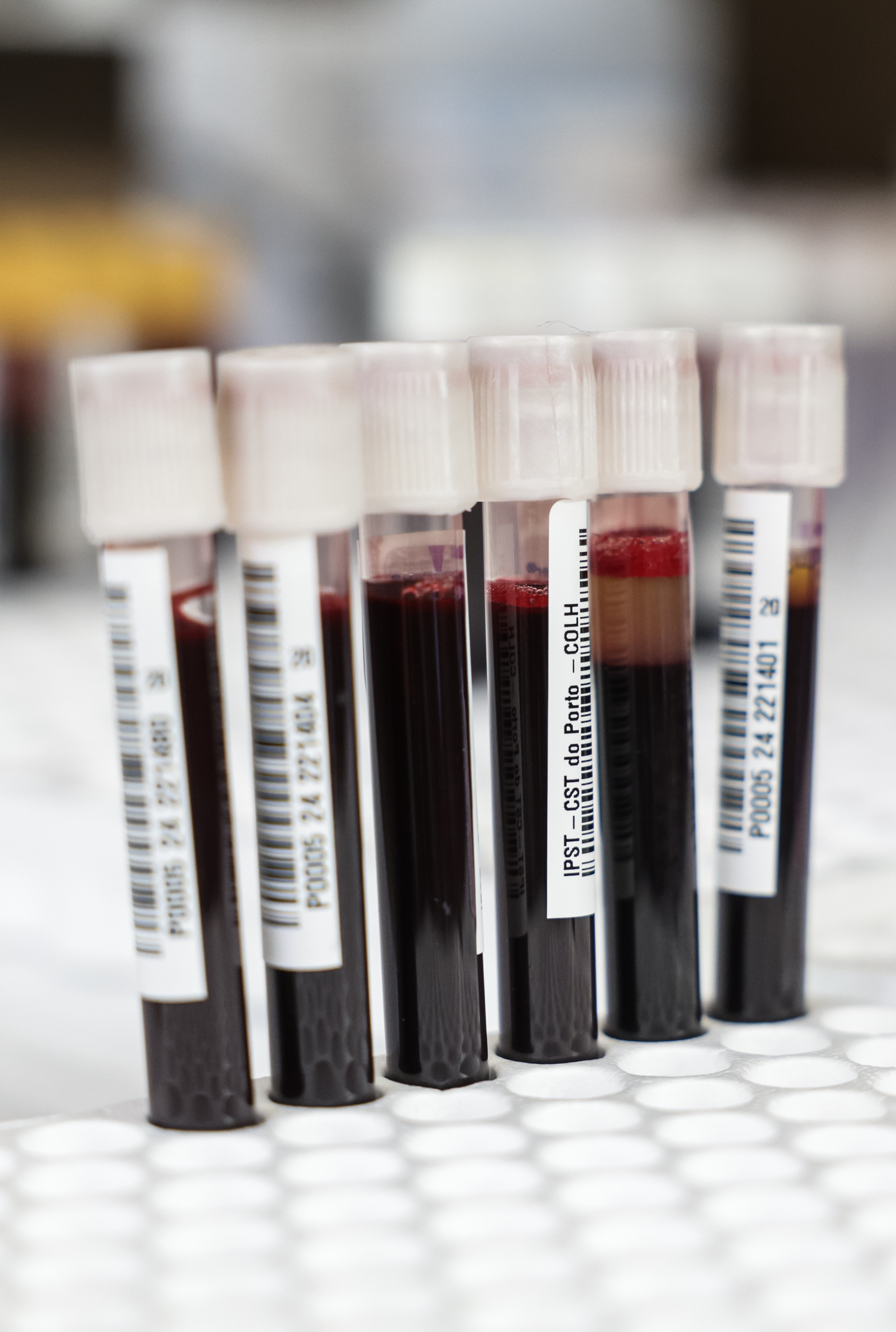 Imagem número 1 da galeria Dádiva de Sangue